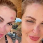 Deolane Bezerra aparece com rosto machucado após acidente em casa e preocupa fãs; veja vídeo