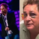 Leonardo sobe ao palco de olho roxo e mantém agenda após acidente; veja vídeo