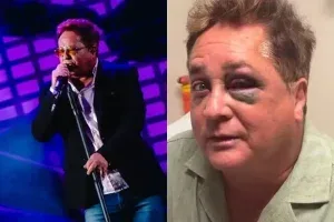 Leonardo sobe ao palco de olho roxo e mantém agenda após acidente; veja vídeo