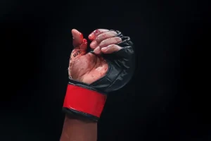 Lutador vence no UFC mesmo com osso do dedo exposto e recebe suspensão de seis meses; veja vídeo