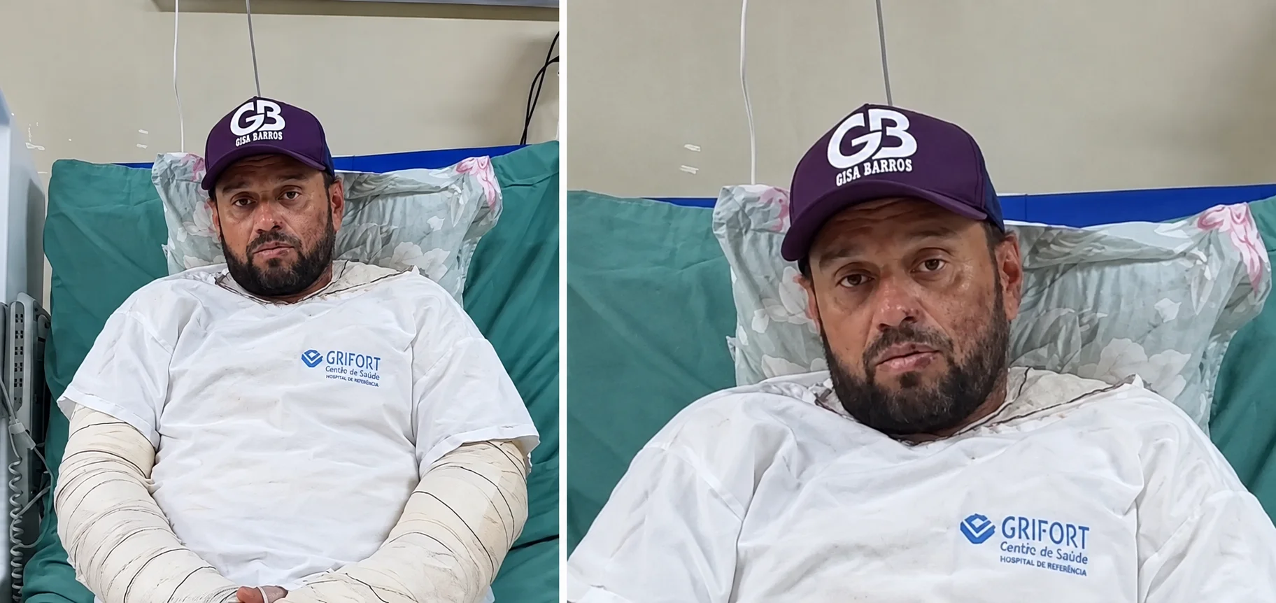 Vereador de Várzea Grande segue internado e revela que não consegue receber visitas devido a gravidade das queimaduras; veja vídeo
